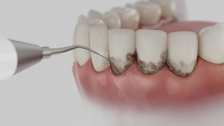 Reliable Dental Implants contractor in Mission, SD by Smile Center Dentistry